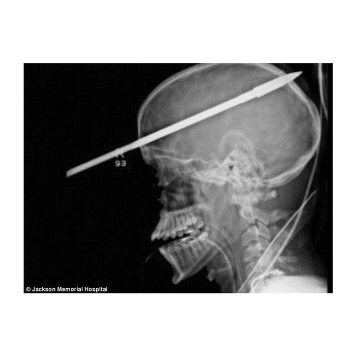 Speargun Safety - How to Handle a Speargun Safely